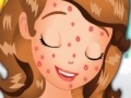 Spēle Sofia Squeeze Pimples