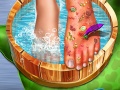 Spēle Feet Skin Doctor