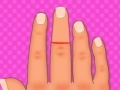 Spēle Finger surgery