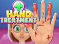 Spēle Hand Treatment