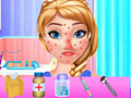 Spēle Anna Spring Allergy Treatment