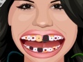 Spēle Selena Gomez Perfect Teeth 